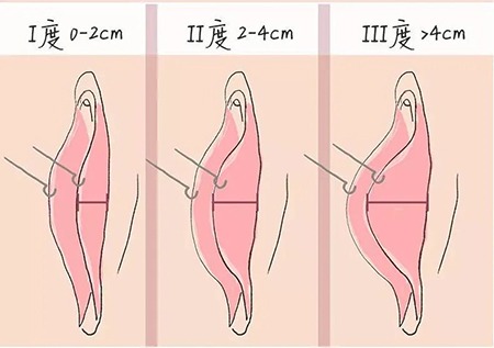 99998254.jpg 640.jpg