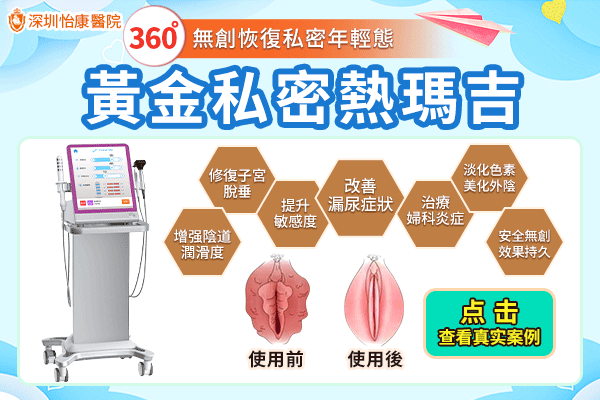 79899599.gif 私密緊縮針-動.gif