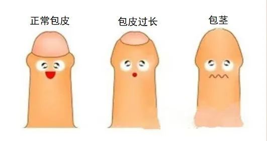 包皮.png